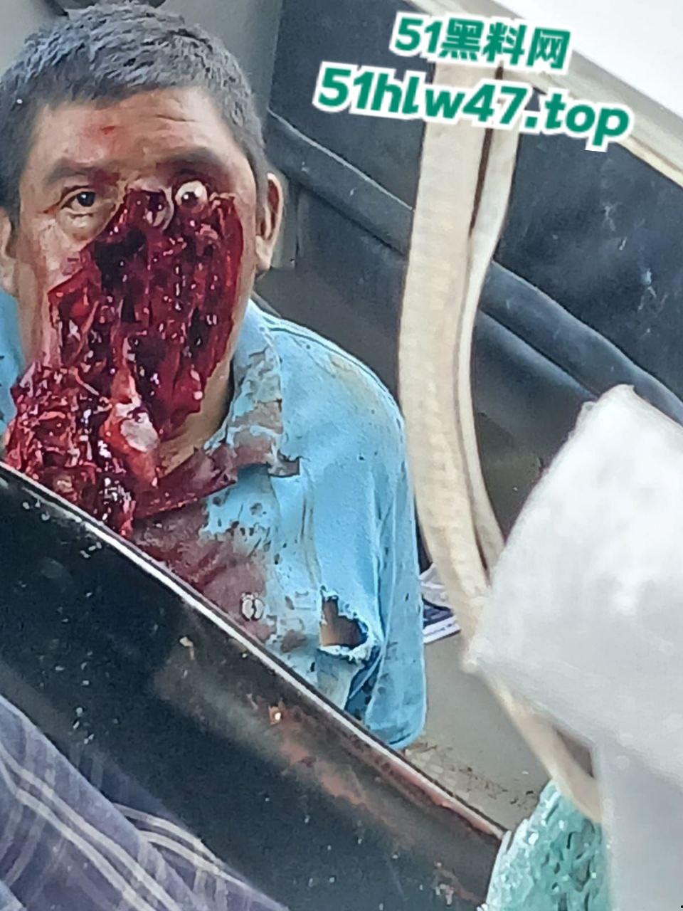 【血腥恐怖】印尼发生惨烈车祸,超速行驶失控后撞上前方货车,导致多人死亡司机直接面目全非。-4