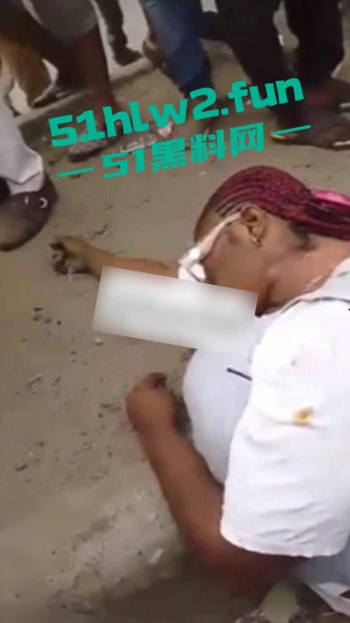 【血腥恐怖】尼日利亚重大车祸一妇女坐在货车前休息,由于视线盲区司机并未发现 将其碾压成两截。-1