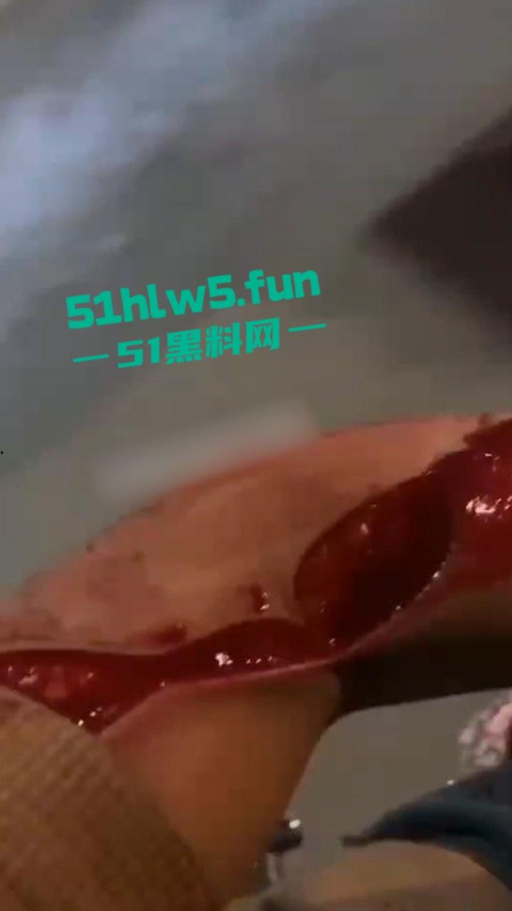 重口血腥场面慎点!广东普宁cw电竞社精神小伙线下真实暴砍对手致皮开肉绽。-3