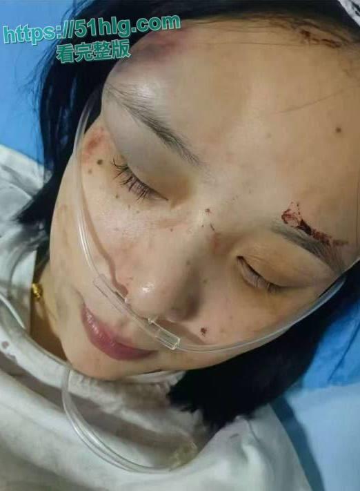 【四川江油】霸凌事件 14岁少女被霸凌 霸凌者母亲利用公安局副局长身份镇压事件 引起民愤围堵公安局-10