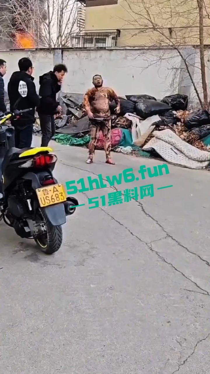 山东济南一小区发生火灾,男子被烧的体无完肤,经调查是邻居大妈积攒的废品导致烧成这样也太惨了。-2