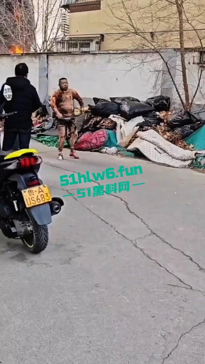 山东济南一小区发生火灾,男子被烧的体无完肤,经调查是邻居大妈积攒的废品导致烧成这样也太惨了。-4