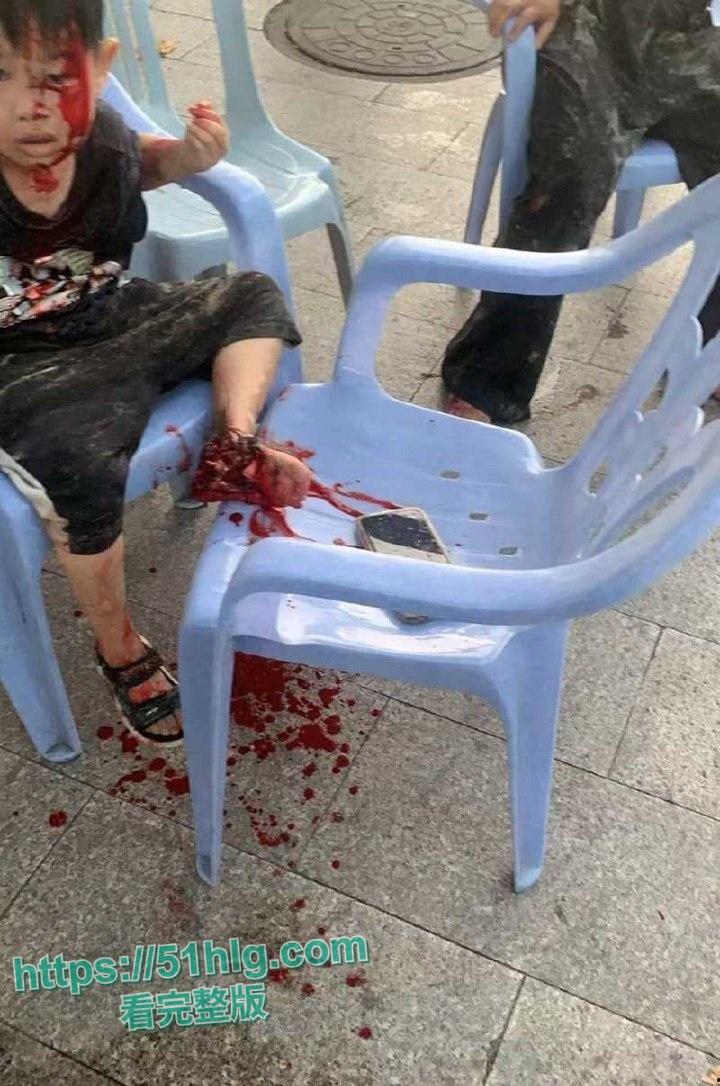 疯狂纵火撞学校!【福建漳州云霄县】司机骇人行径震惊众人,多名学生受伤 现场一片血肉横飞惨象-5