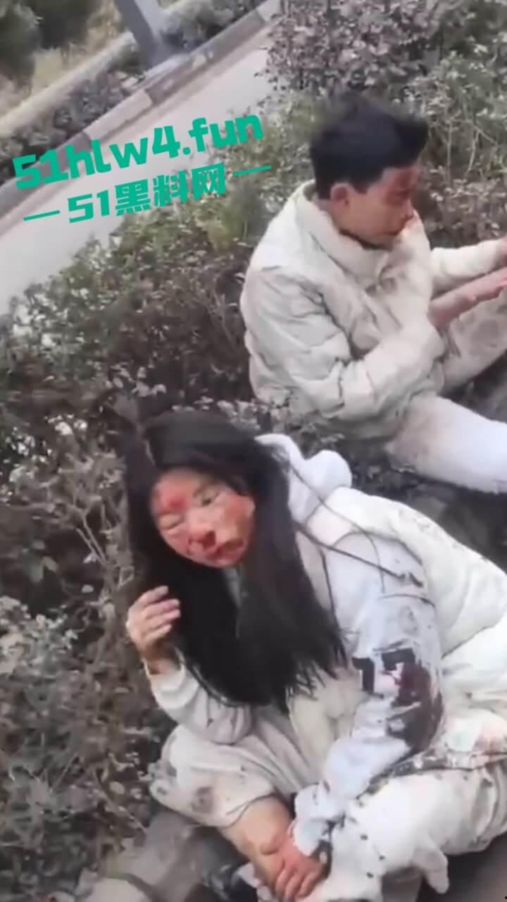 内江资中奇葩车祸五菱宏光加速超车,竟然失控出车祸俩人都变成熊猫脸,看着太搞笑了。-4