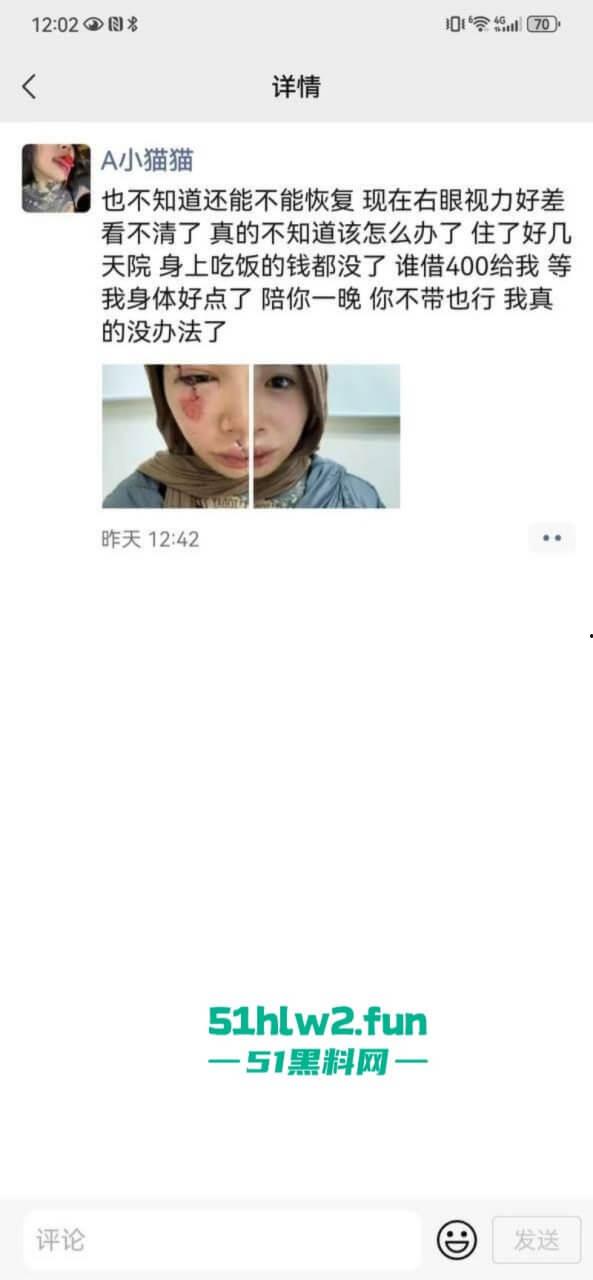 卖惨惯犯纹身妹,骑电瓶车出车祸惨遭破相朋友圈无奈卖身求钱就医,骚货的卖身已成习惯。-5