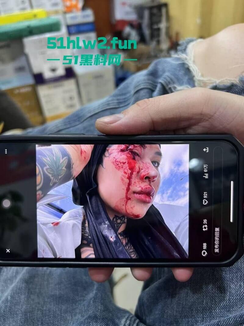 卖惨惯犯纹身妹,骑电瓶车出车祸惨遭破相朋友圈无奈卖身求钱就医,骚货的卖身已成习惯。-7