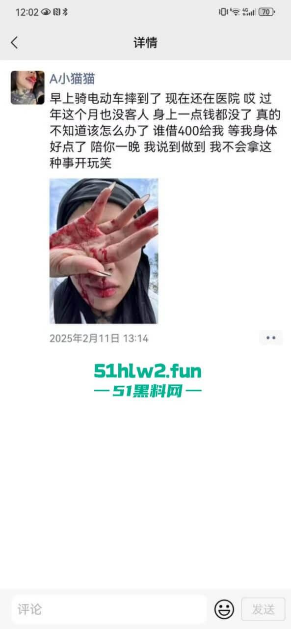 卖惨惯犯纹身妹,骑电瓶车出车祸惨遭破相朋友圈无奈卖身求钱就医,骚货的卖身已成习惯。-8