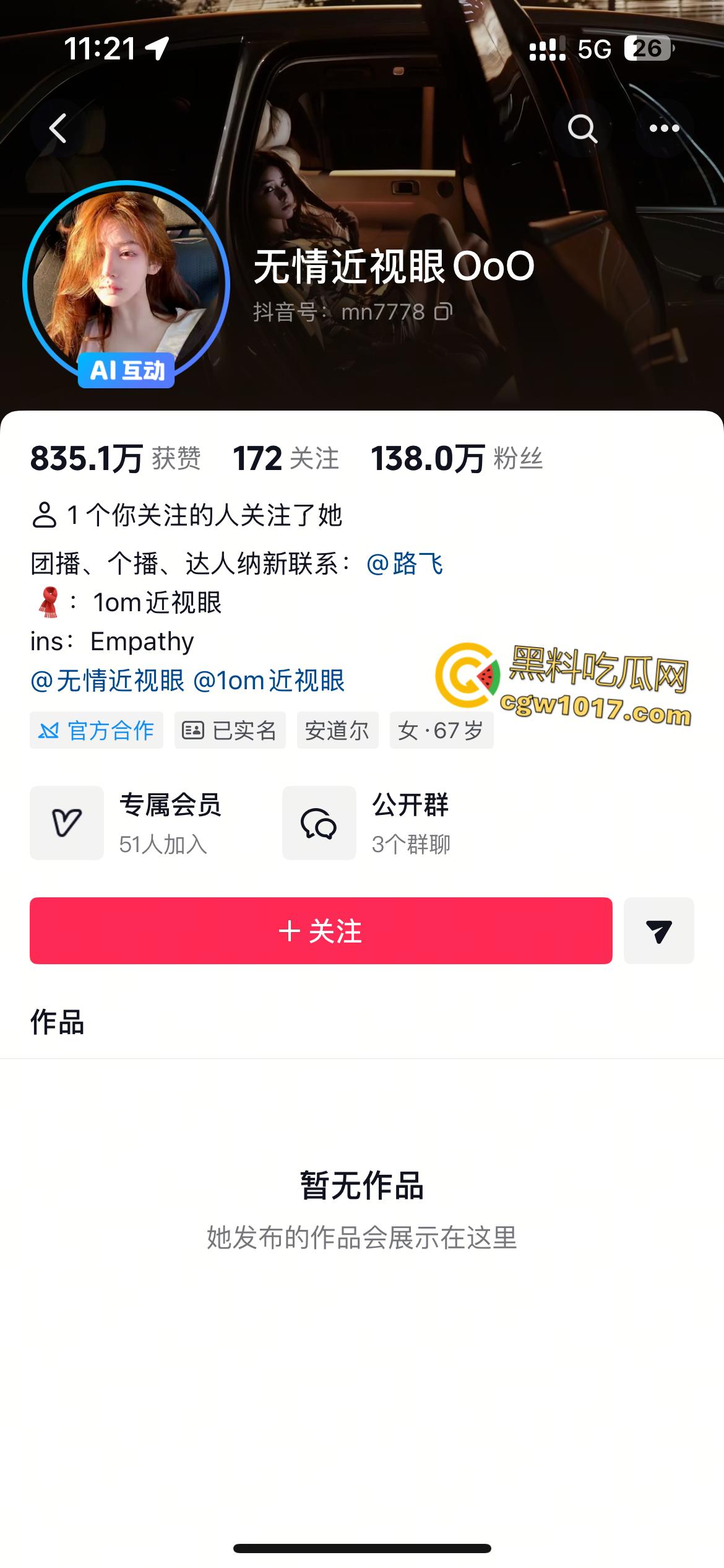 极品御姐网红【无情近视眼】,写真私拍流出,良家少妇变顶级骚货,豪乳蜜桃臀撩人,眼神饥渴血脉喷张!-1