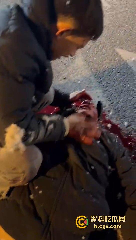 西安立交桥两男子醉酒骑摩托撞护栏,一男子爆头止血,没想到面包车又来补一刀!-10