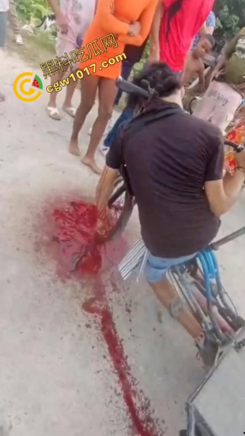 恐怖视频曝光！小伙头颅神秘贯穿，三轮车穿颅血染街头血腥现场骇人惊魂，神秘死亡惊掉下巴！-6