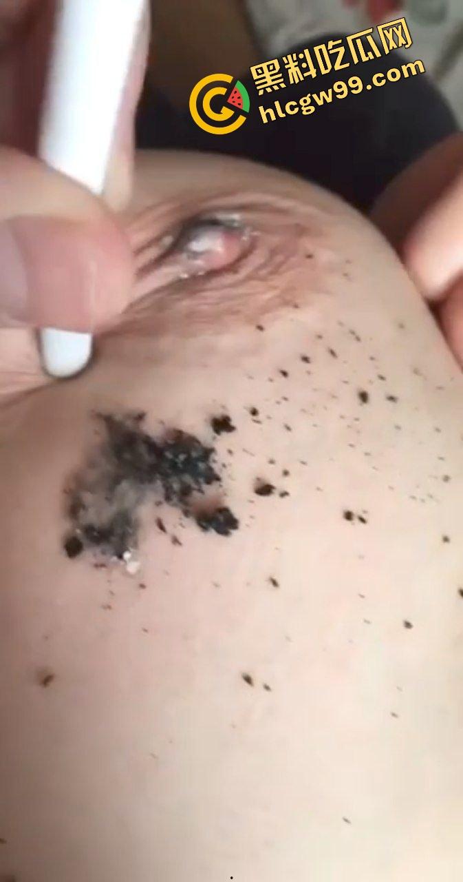 江苏极品E奶大雷少妇骚鸡，尝试猎奇刺激玩法虐乳！暴力夹乳针头注射奶头烟头烫咪咪！诠释何为调教！-9