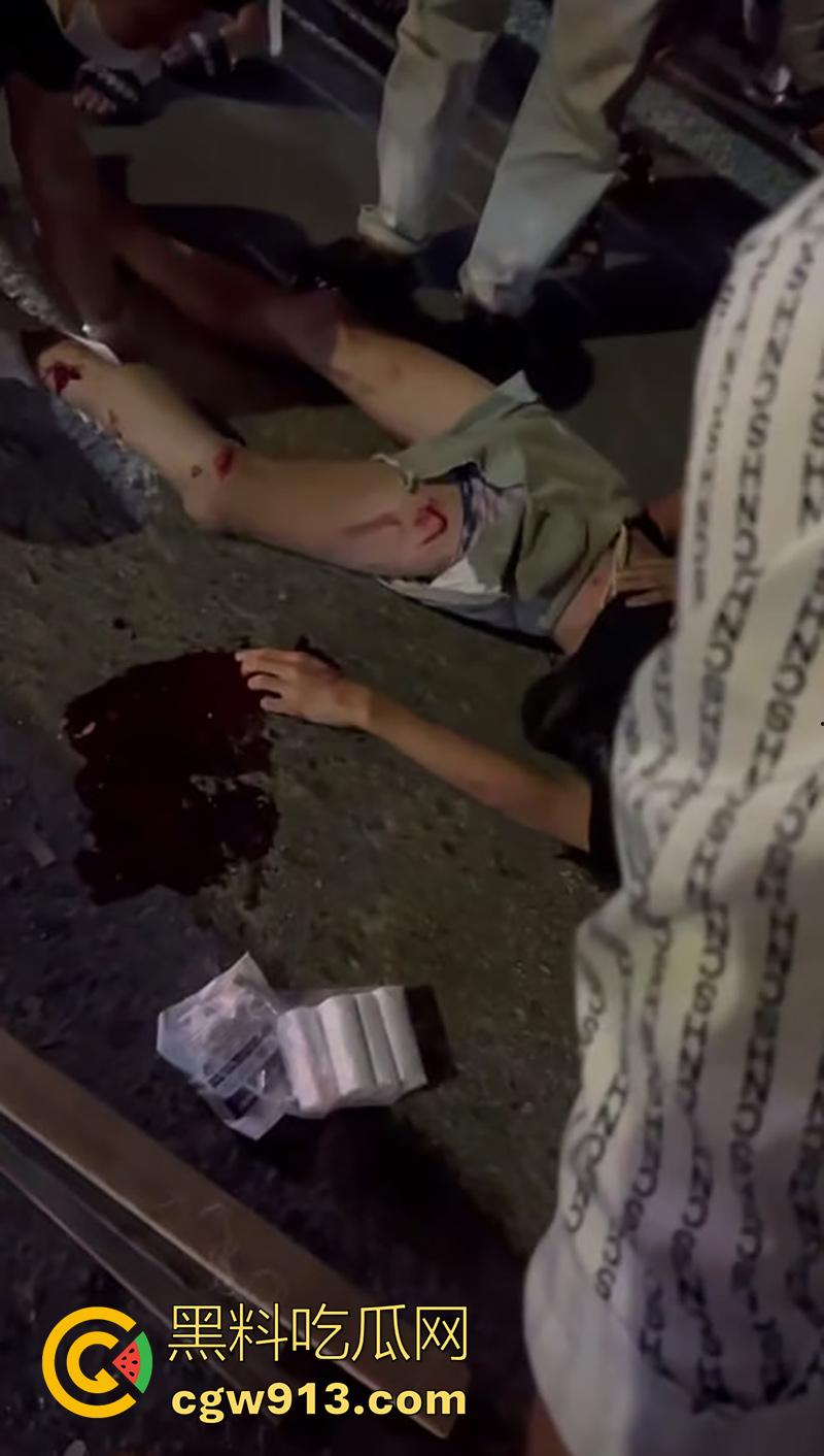 小伙骑摩托车夜晚狂飙,车辆失控撞上对面来车,女友当场飞出死亡,小伙自己全身骨折,看着都疼!-4