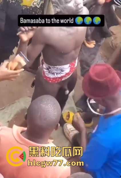 非洲部落割包皮 这也太生猛了吧 包皮一拉一刀下去直接割掉 这老哥全程面无表情！-3