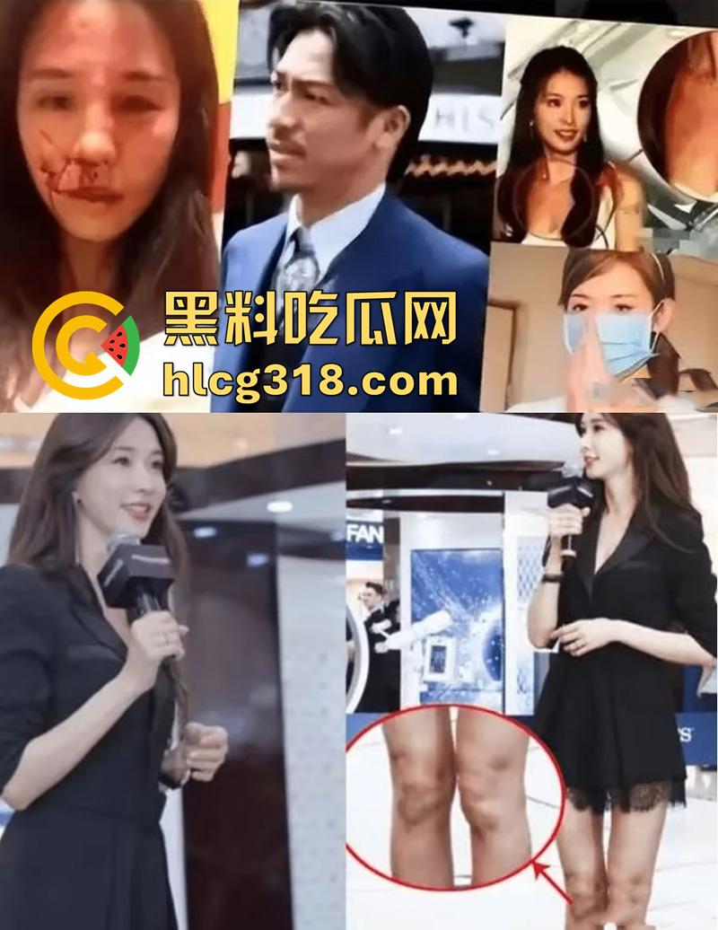 林志玲嫁入日本后真实近况，不仅被老公殴打家暴，还用她的身体交换资源，甚至多次玩换妻游戏！-2