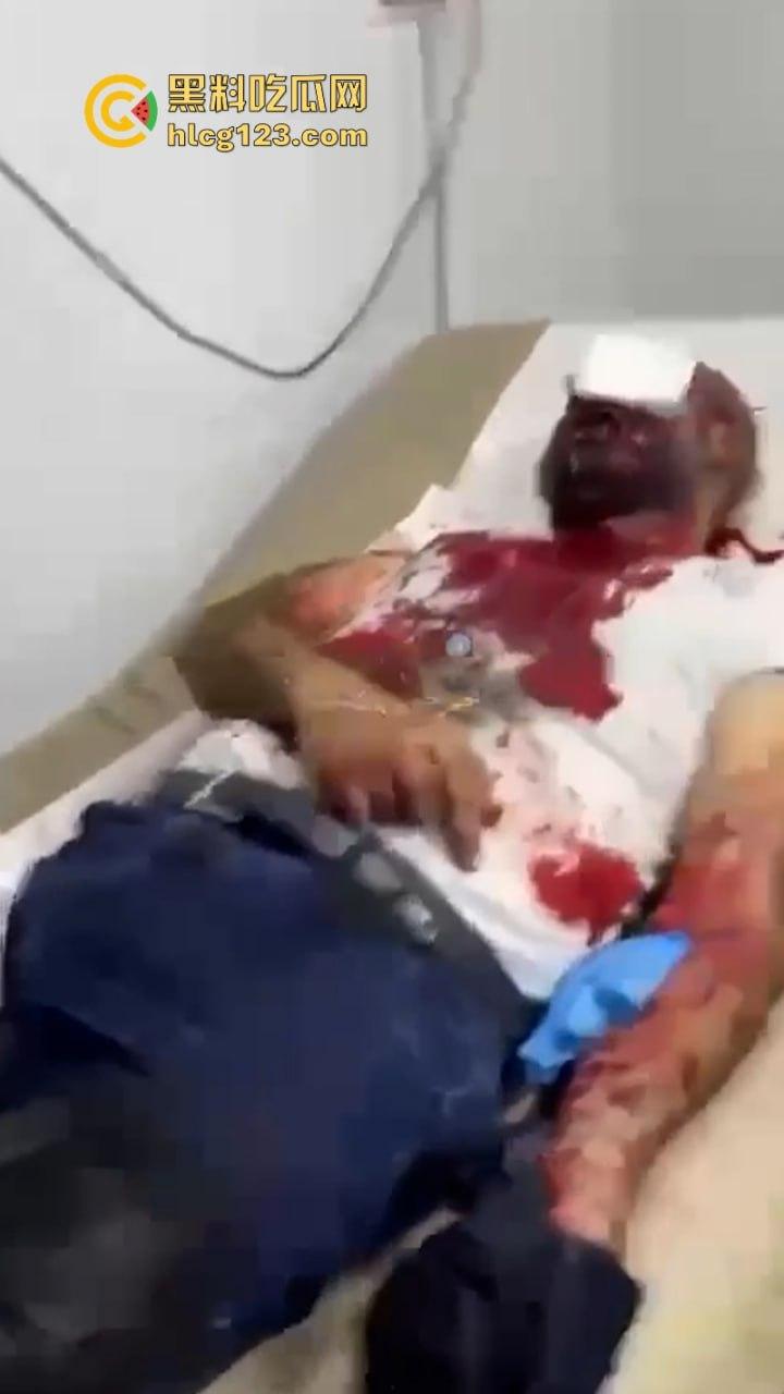 黎巴嫩发生大规模BP机爆炸事件 4000多人受伤 11人死亡 以色列远程植爆-7