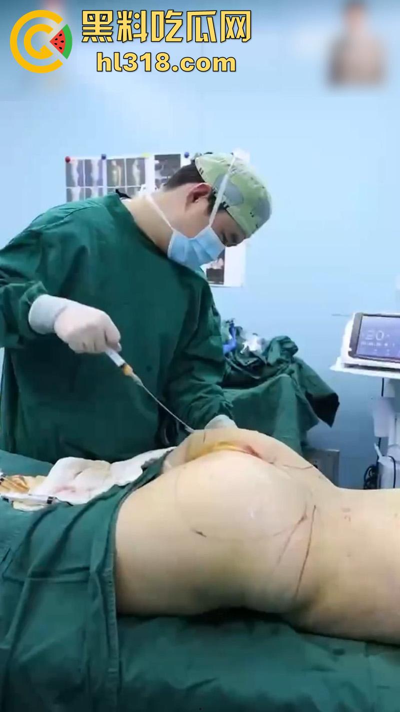 实拍整形医院手术现场，小仙女为了变美，抽脂和填充全过程，虽然看着残忍，但做完后的确是好看呢！-9