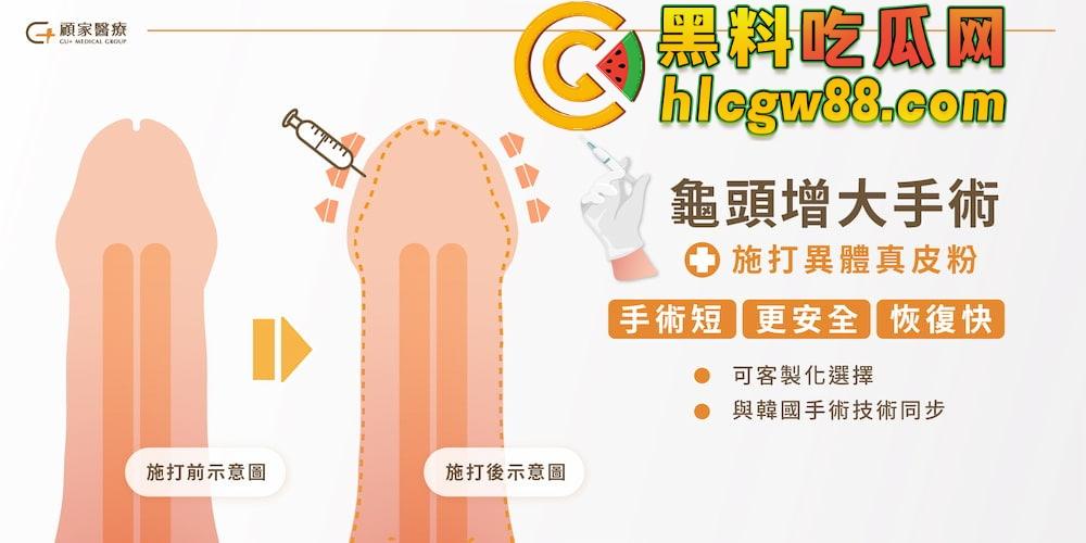 小鸟变大雕换炮计划！阴茎增大手术震撼实测 9CM秒变18CM战神之枪 ，这根真的压不住了！-9