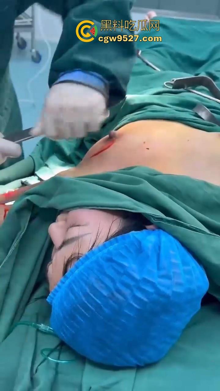 隆胸整形手术现场大曝光！平乳妹秒变巨乳御姐，手术过程一览无遗，女人为变美的代价真大！-4
