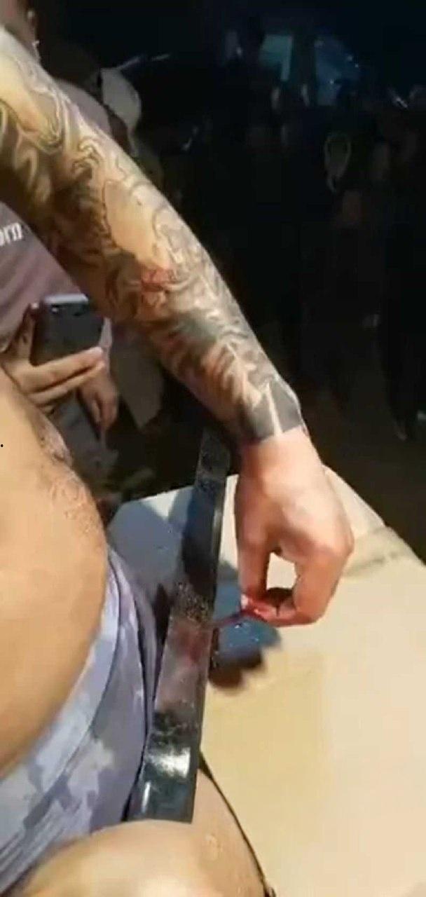 猎奇的重口慎入！男子当街表演，男子拿着砍刀割包皮，满桌子都是血，是因为不想让医院挣那么多钱吗 ?-7