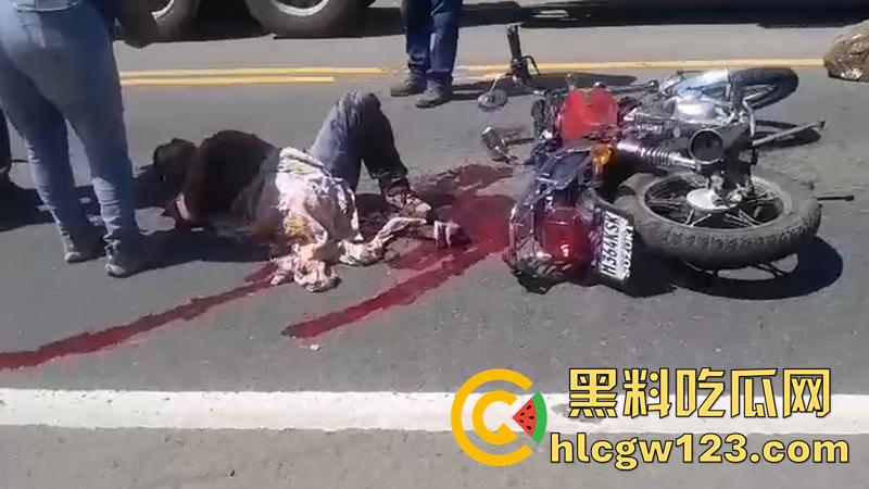 血腥恐怖交通事故，圣克鲁斯男骑手出车祸，左腿被当场撞断，现场视频流出胆小者勿入！-2