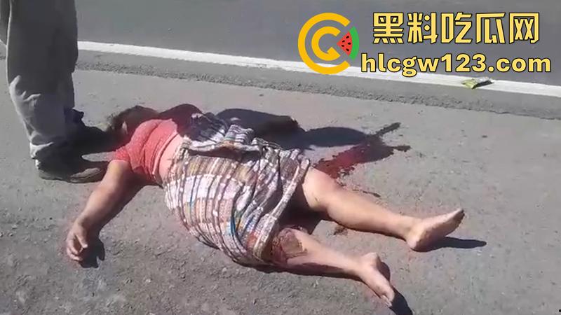 血腥恐怖交通事故，圣克鲁斯男骑手出车祸，左腿被当场撞断，现场视频流出胆小者勿入！-3