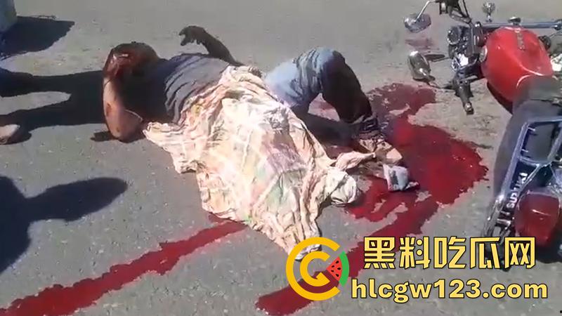 血腥恐怖交通事故，圣克鲁斯男骑手出车祸，左腿被当场撞断，现场视频流出胆小者勿入！-7