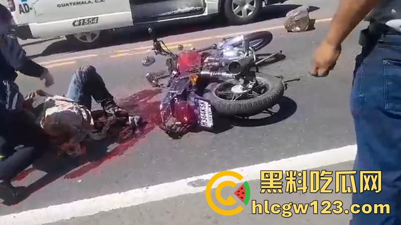 血腥恐怖交通事故，圣克鲁斯男骑手出车祸，左腿被当场撞断，现场视频流出胆小者勿入！-8