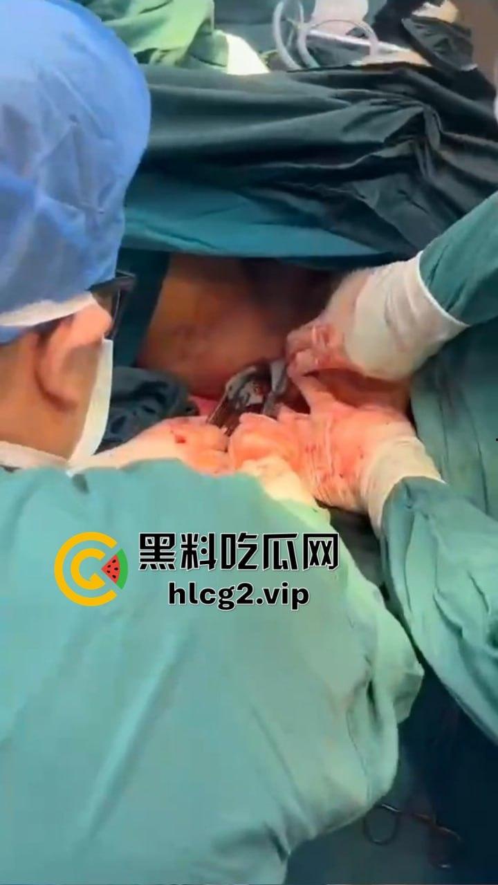 重口慎点！男子硬塞20厘米假体进体内，女子螃蟹夹逼狠整，为了流量太拼了！-11