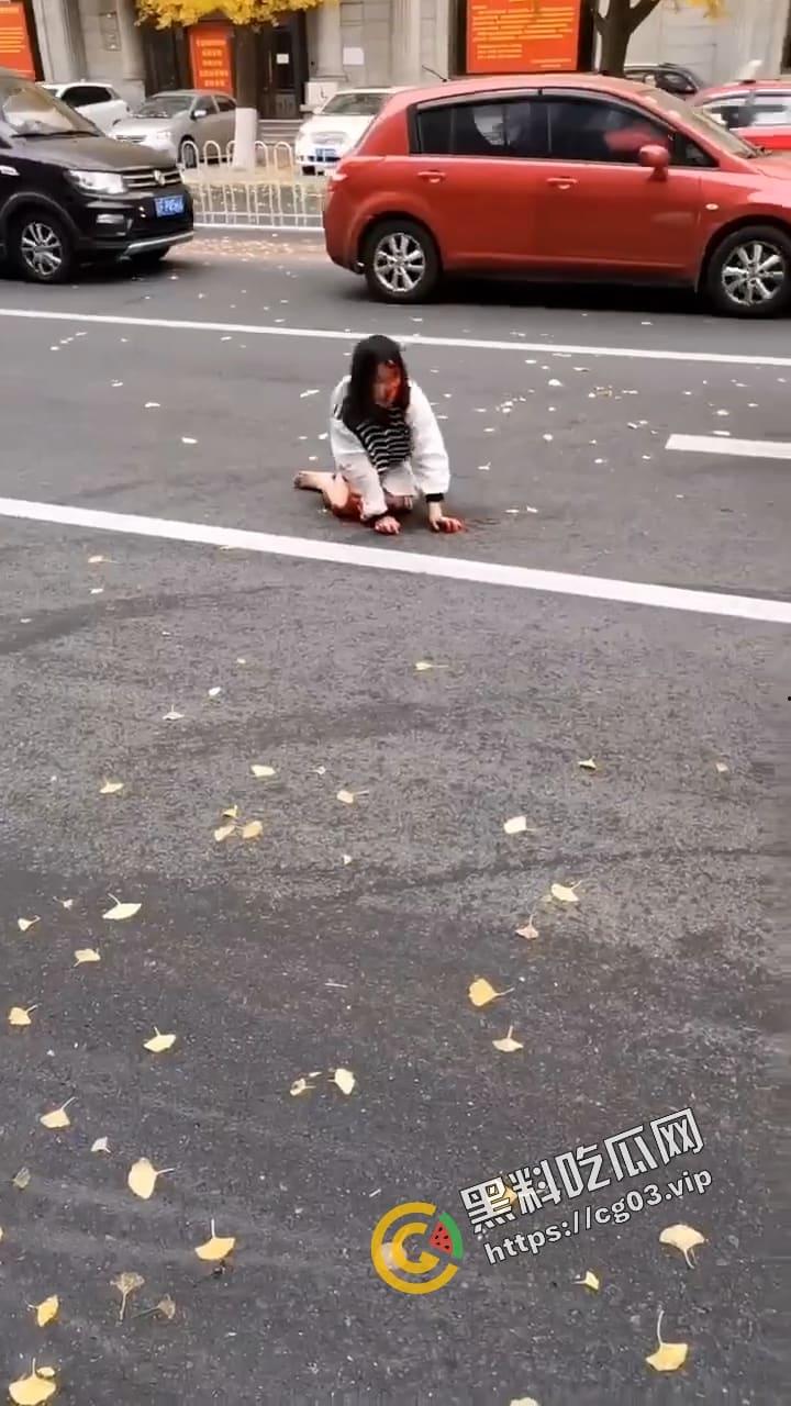 辽宁丹东街头 女子满头鲜血狼狈不堪 自称朝鲜人被骗到按摩店工作  这是逃出来的不想活了-3