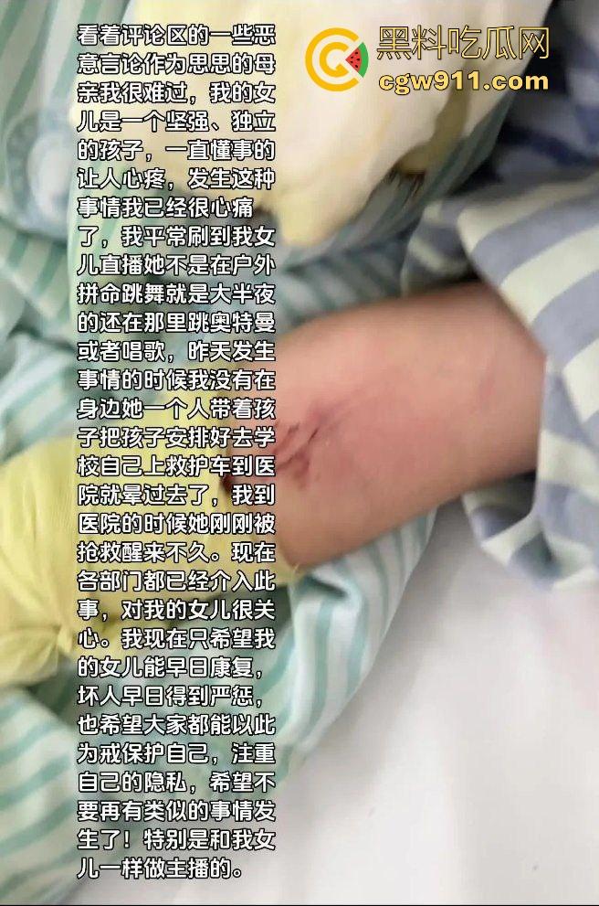 湖南性感擦边主播遭疯狂粉丝寄炸弹包裹炸伤，粉丝疯狂起来真恐怖啊，好端端的性感主播炸成了隔壁大妈！-8