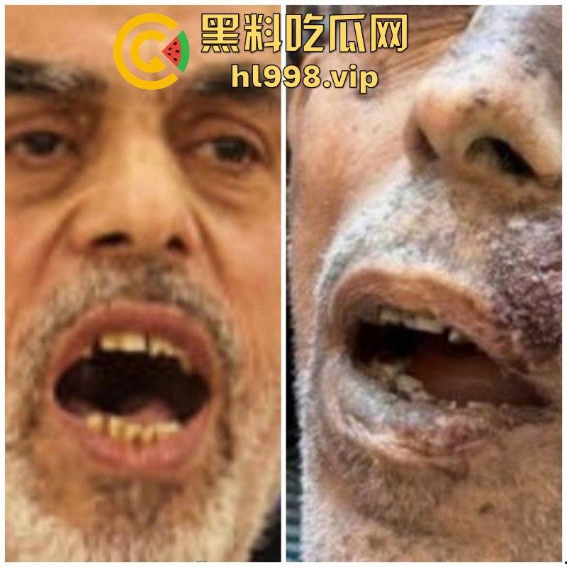 慎入!!!哈马斯领导人辛瓦尔被以方爆头击毙 遗体照片流露不忍直视!-10