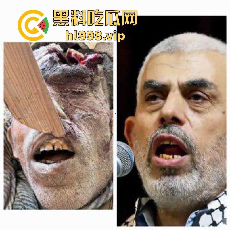 慎入!!!哈马斯领导人辛瓦尔被以方爆头击毙 遗体照片流露不忍直视!-11
