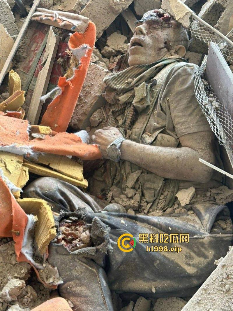 慎入!!!哈马斯领导人辛瓦尔被以方爆头击毙 遗体照片流露不忍直视!-12