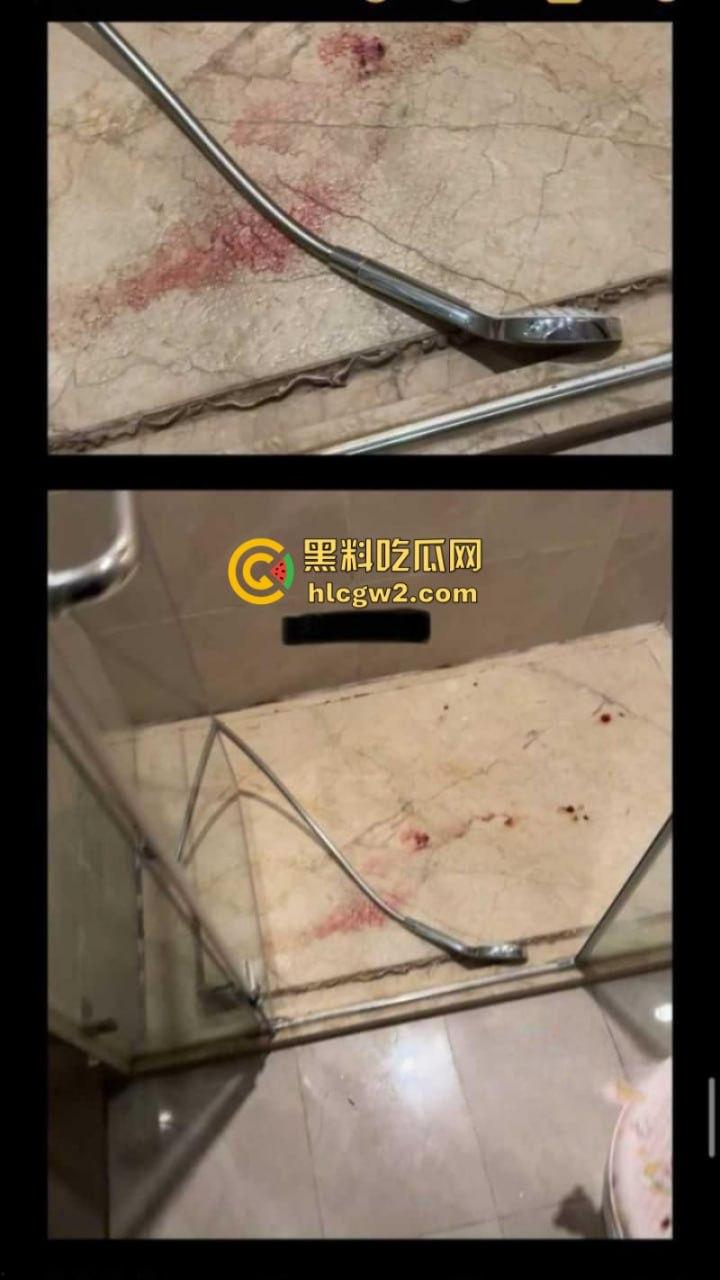 要想啪啪更有力 操前就先打笑气 百万清纯网红【困困】被男友曝光私生活糜烂 出轨滥交还磕药 自拍约炮视频流出-11