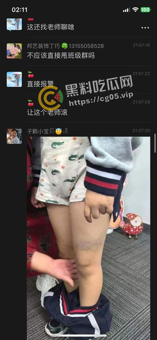 泰州外国语小学老师暴打小学生 全身淤青 家长群内声讨被解散 至今无说法-10