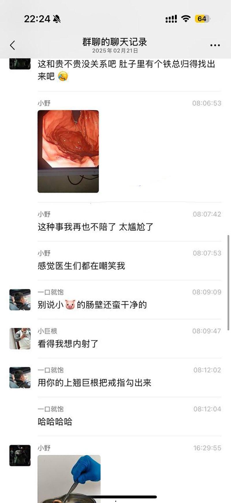 真刺激！男模激情拳交玩过火，结果金戒指卡屁眼里，深夜紧急送医取出，医生直叹牛逼-10