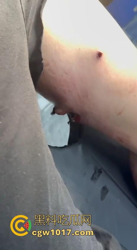 妙瓦底顺达园区缅甸KUN武装屠杀中国人！抢劫、轮奸、枪杀地盘之争，诈骗人员沦落为牺牲品，这时候你是中国人啦！-10