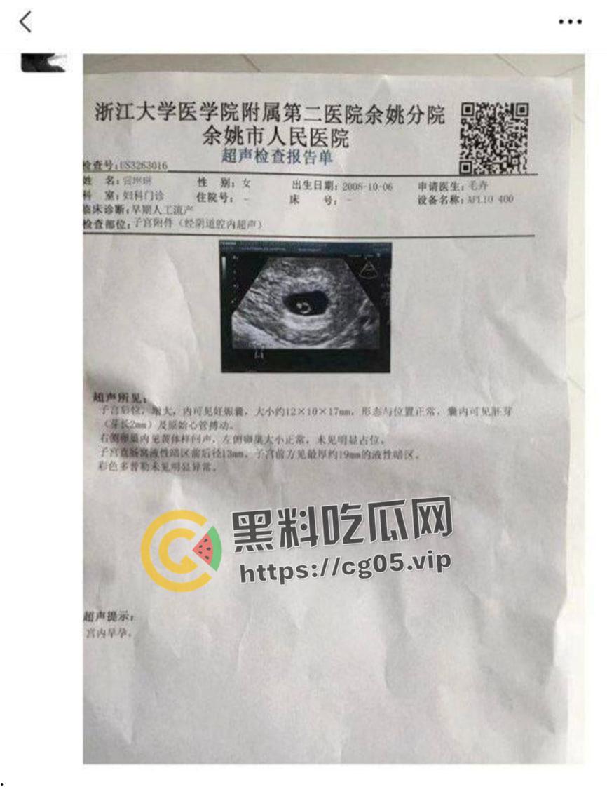 浙江余姚【雷琳琳】喜当妈 打野炮男友不愿做接盘侠 反手将臭婊子被曝光-1