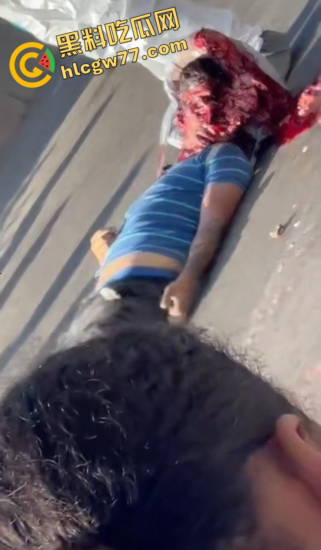 蓝色衣服男电动车车祸爆头血腥惨剧！眼珠弹出还能救？世上竟有神人？-3