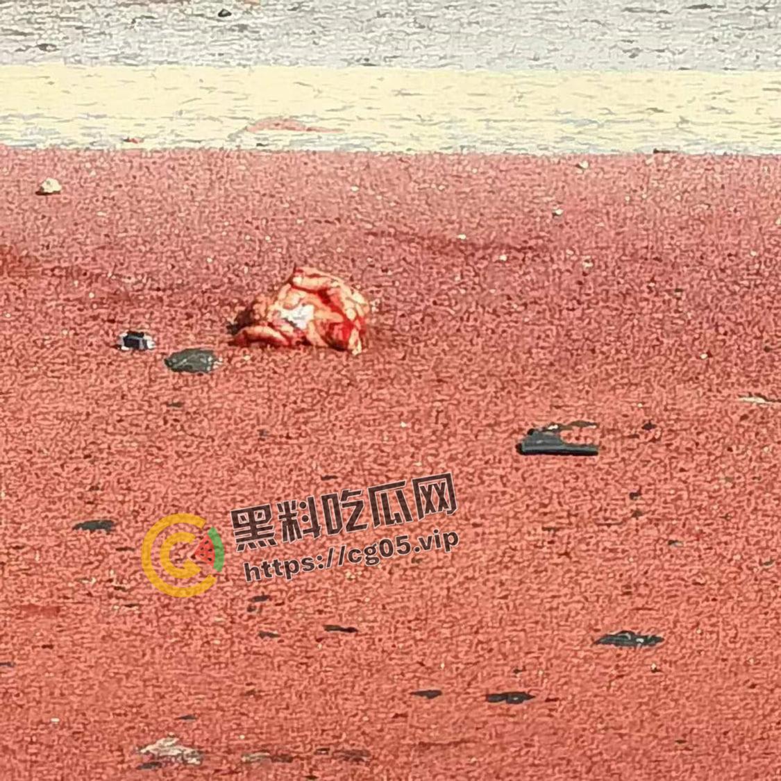 浙江极氪001撞死横穿马路路人 人头分离 整个脑浆撞出来了 现场血腥画面报告-4