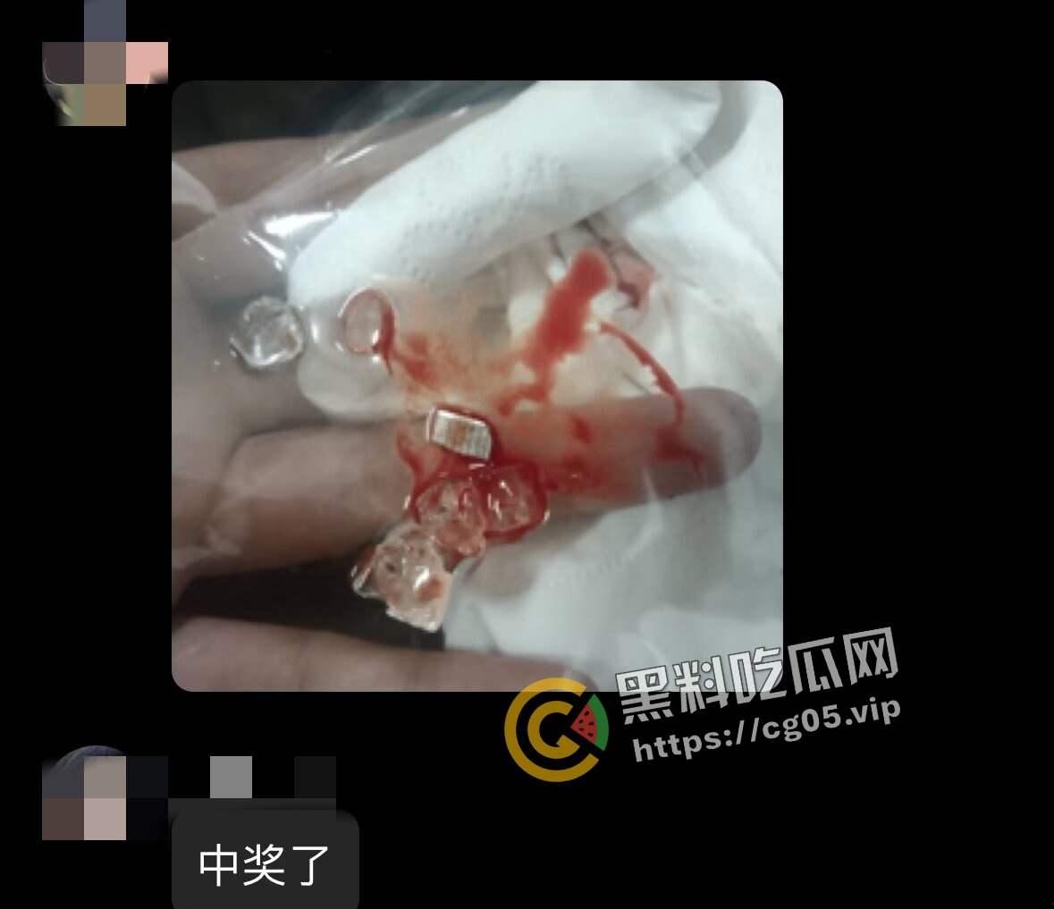 济南幻樱漫展投毒事件！多人在漫展收到免费赠送的零食中发现刀片 药丸等异物 附上相关报道以及漫展骚货视频-2