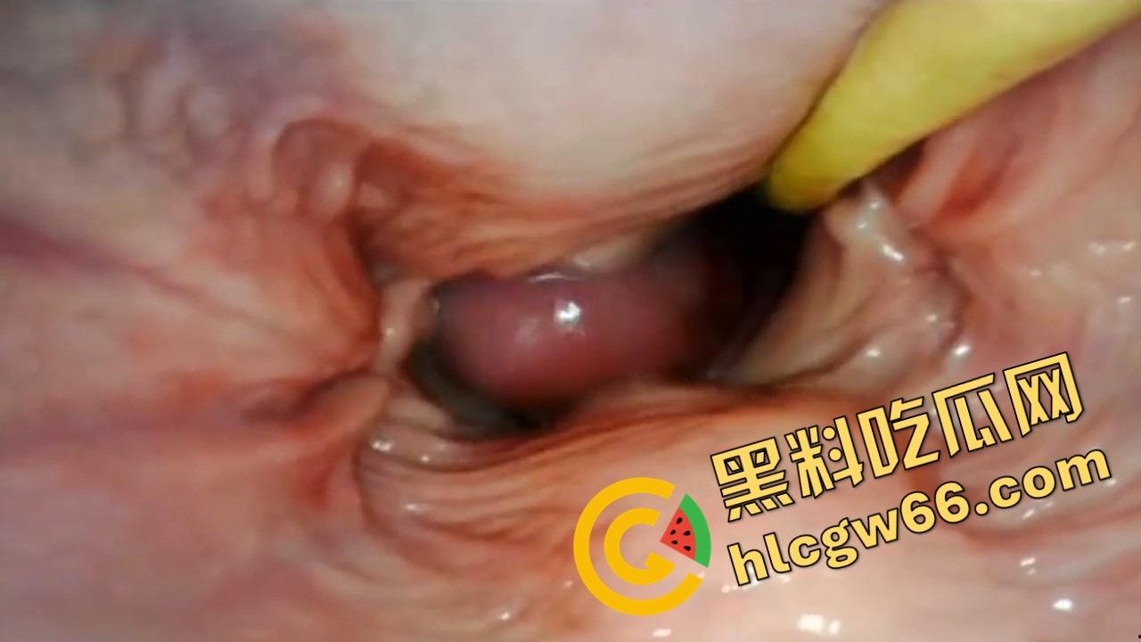 欧美巨屌狂插内窥视角爆火阴道深处褶皱翻卷、肉壁收缩蠕动,全程高清记录快感源头!-9