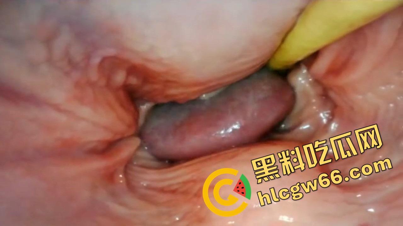 欧美巨屌狂插内窥视角爆火阴道深处褶皱翻卷、肉壁收缩蠕动,全程高清记录快感源头!-10