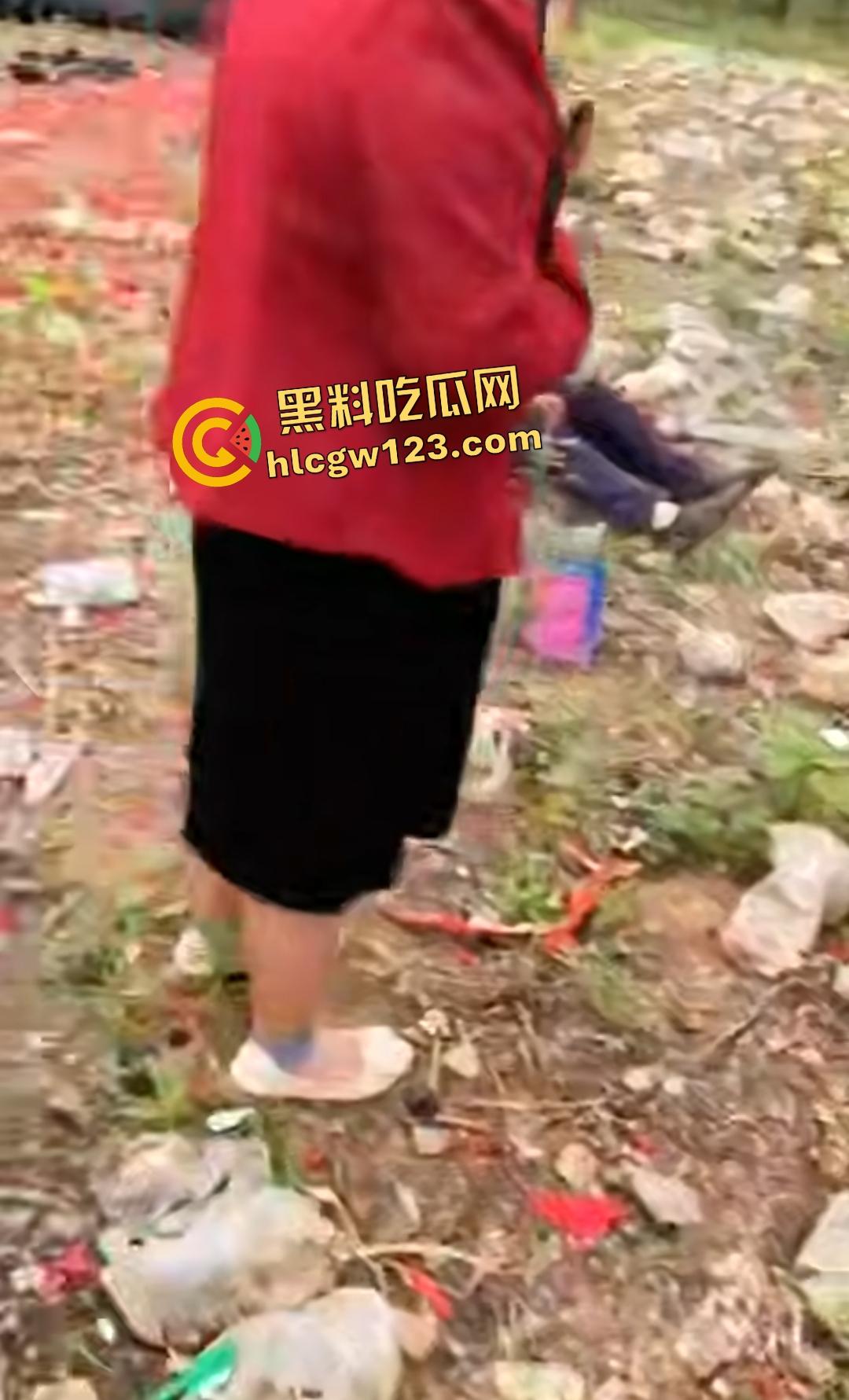 河南平顶山鲁山王大爷捡烟花炸头变黑鬼!右眼已瞎保不住,脑子里有骨头渣!-1