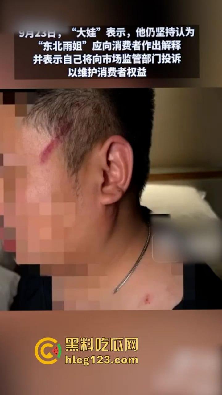 一分钟收入100w?抖音千万网红 【东北雨姐】售卖假红薯粉粉涉嫌虚假宣被打假!-16