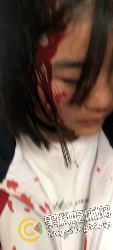 霸凌合集! 群殴暴打 强迫虐阴  是人性扭曲还是环境所迫？（十四）-9