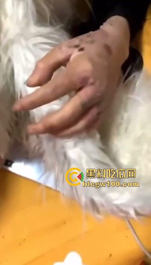 河南信阳啤酒森林酒吧惊现病毒母体!毒王身体浑身溃烂吓退众人,最近国内真的特别多各位瓜友一定要注意。-18