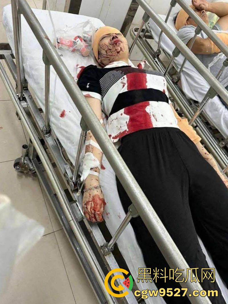 越南海防水果批发市场，发生重大砍人事件，男子手持菜刀疯狂劈砍，导致三人身受重伤，现场视频流出！-1