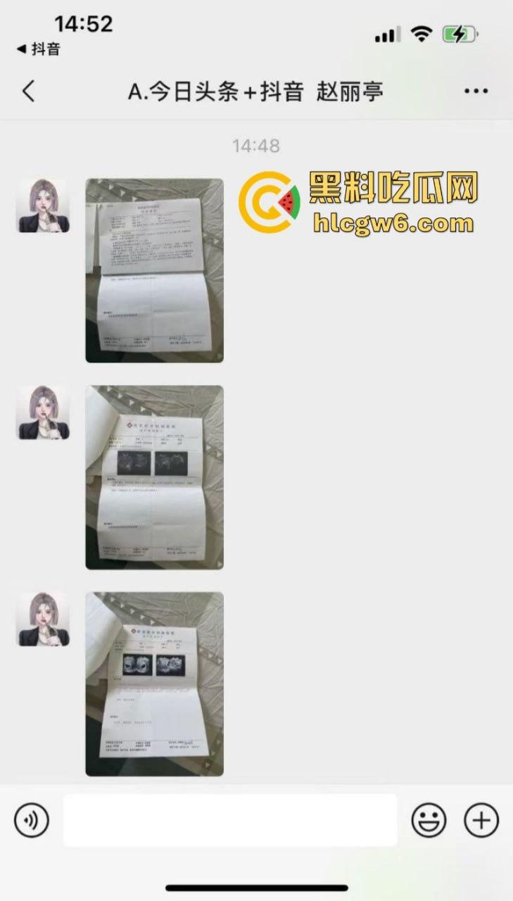 山西汾阳【赵丽婷】婚内出轨 结婚五年频繁出轨并打胎5次 被老公曝光并附带视频!-1