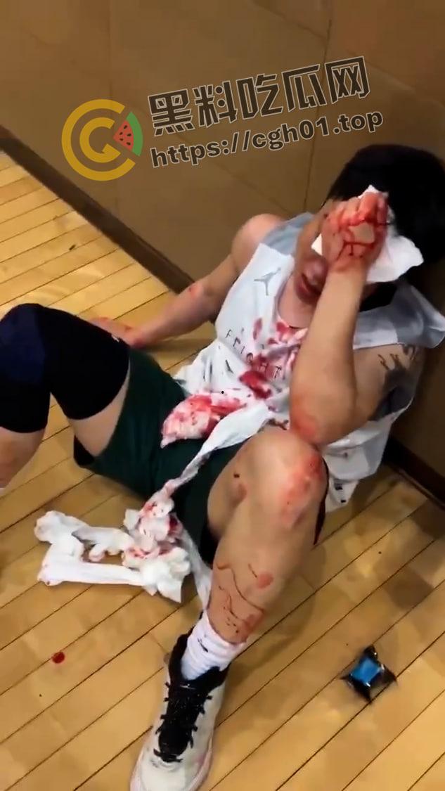 一场野球挣了66w！广州汇悦台野球场暴躁男【王帅】打球带肘给人开瓢   赔66w才能免坐牢-4